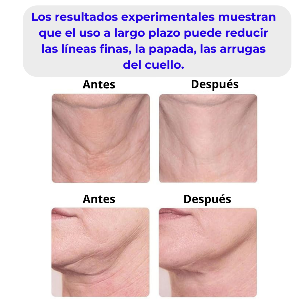 Masajeador Facial Eléctrico.